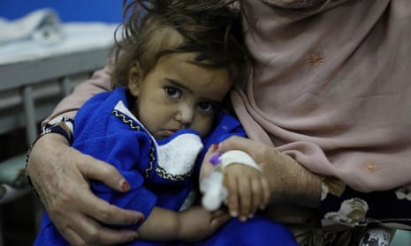 A woman holds her sick granddaughter in the malnutrition ward of Indira Gandhi children's hospital in Kabul