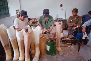 A Cambodian soldier waits at an ICRC clinic in Ho Chi Minh for a new prosthetic leg, in Ho’ Ville, Vietnam, 1989