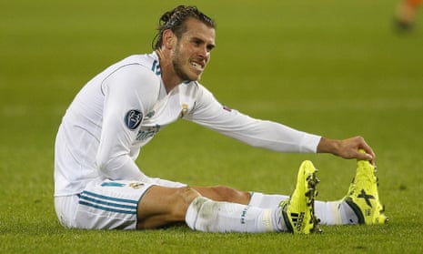 Gareth Bale was injured in the Champions League game between Real Madrid and Borussia Dortmund last week.