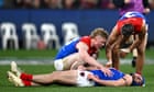 Concussion a difficulty AFL can’t afford to smother | Jonathan Horn