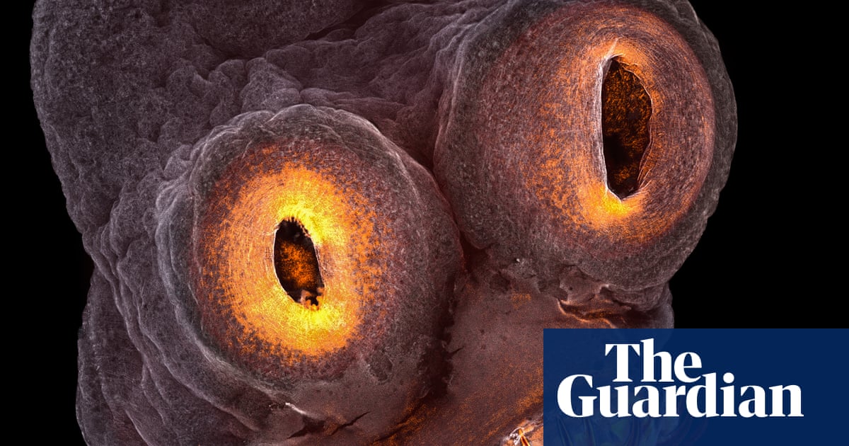 Distinct Microbiome and Metabolites Linked with Depression The Scientist Magazin
