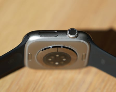 The side button and digital crown of the Apple Watch Series 11.