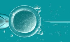 Western Australian law stipulates eggs or sperm from deceased people cannot be use in IVF.
