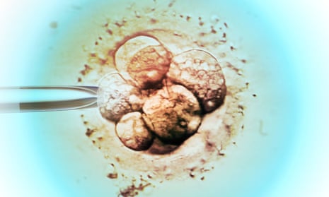A light micrograph showing embryo selection for in vitro fertilisation. 