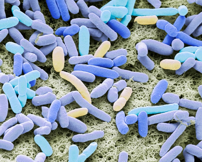 Sharp global rise in antibiotic-resistant infections in hospitals, WHO finds