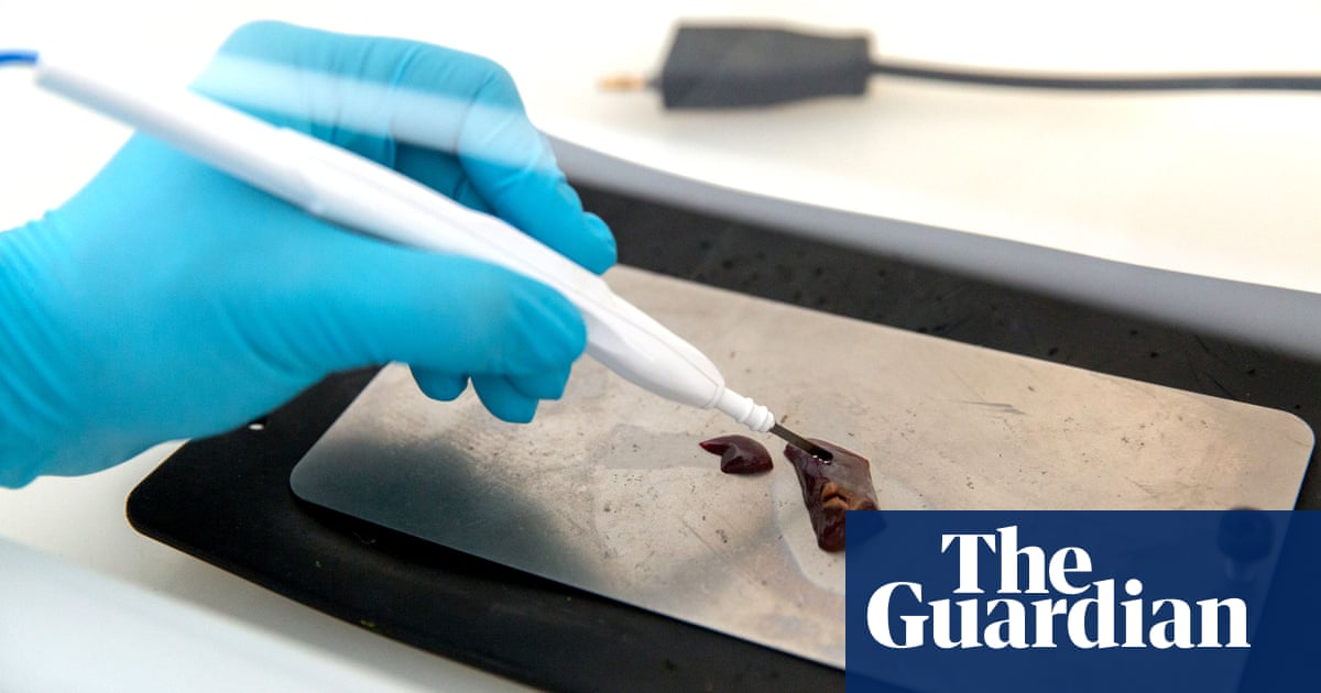 Knife that ‘smells tumours’ can detect womb cancer within seconds