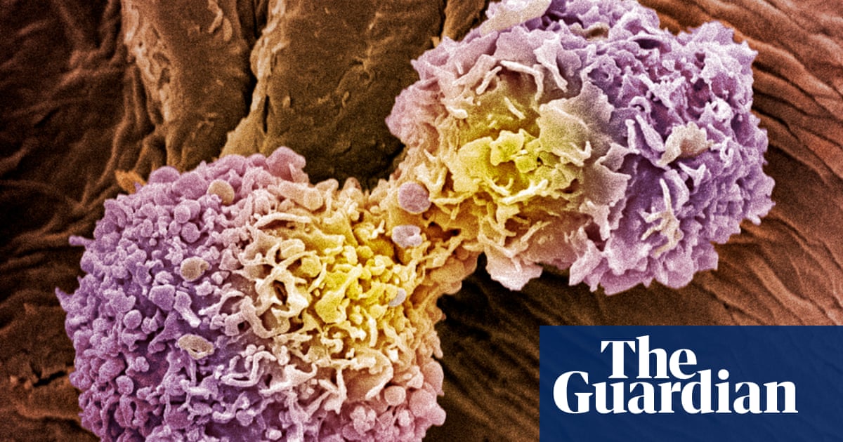 Scientists develop 10-minute universal cancer test