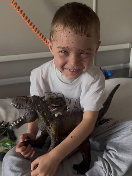 A little boy sits on a hospital bed holding two plastic dinosaurs and smiling.