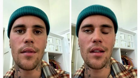 What Happened To Justin Bieber? Shocking Truth Revealed!