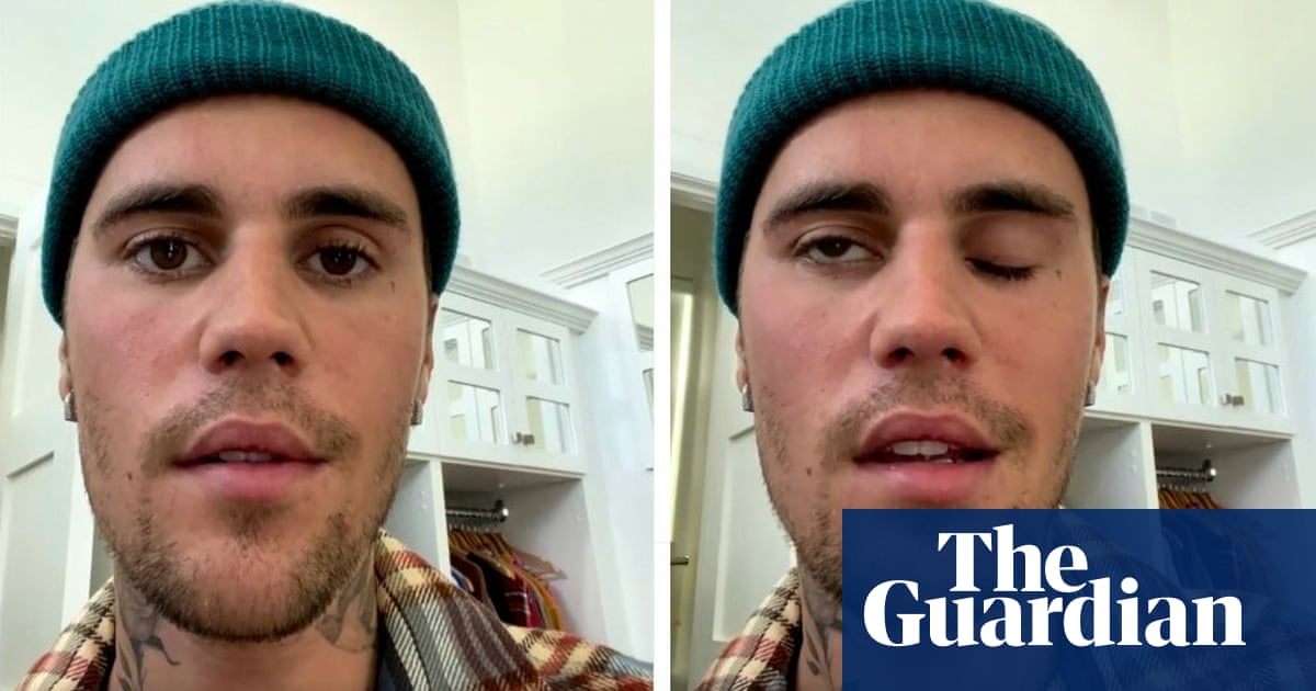 Justin Bieber cancels shows after half of face left paralysed by virus – The Guardian
