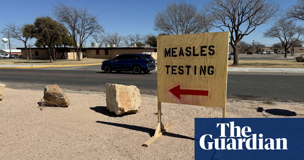 Measles cases in Texas rise to 663 amid outbreaks in other US states