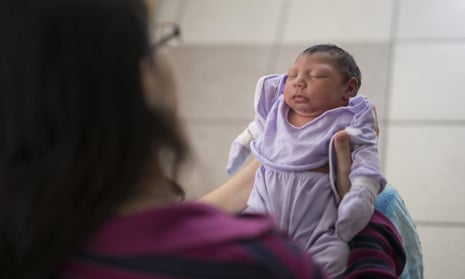 Baby born with microcephaly in a Brazilian hospital. 