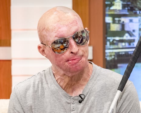 Daniel Rotariu appears on the Good Morning Britain TV show in July 2017.