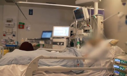 A critically ill patient in the intensive care unit at University College Hospital in London.