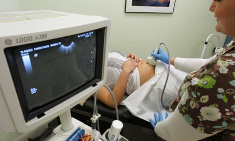 Kansas 'dismemberment abortion' ban