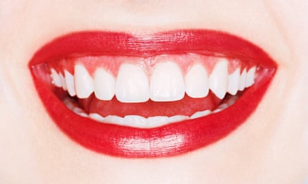 Closeup of woman with perfect white teeth