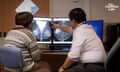 Artificial-intelligence software called Mia is being trialled by NHS Grampian with the aim to increase early detection of cancer and deliver faster mammogram results to patients