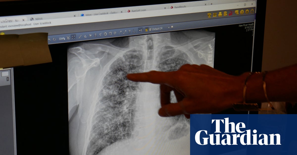 We know how to prevent black lung, so why are workers still dying?
