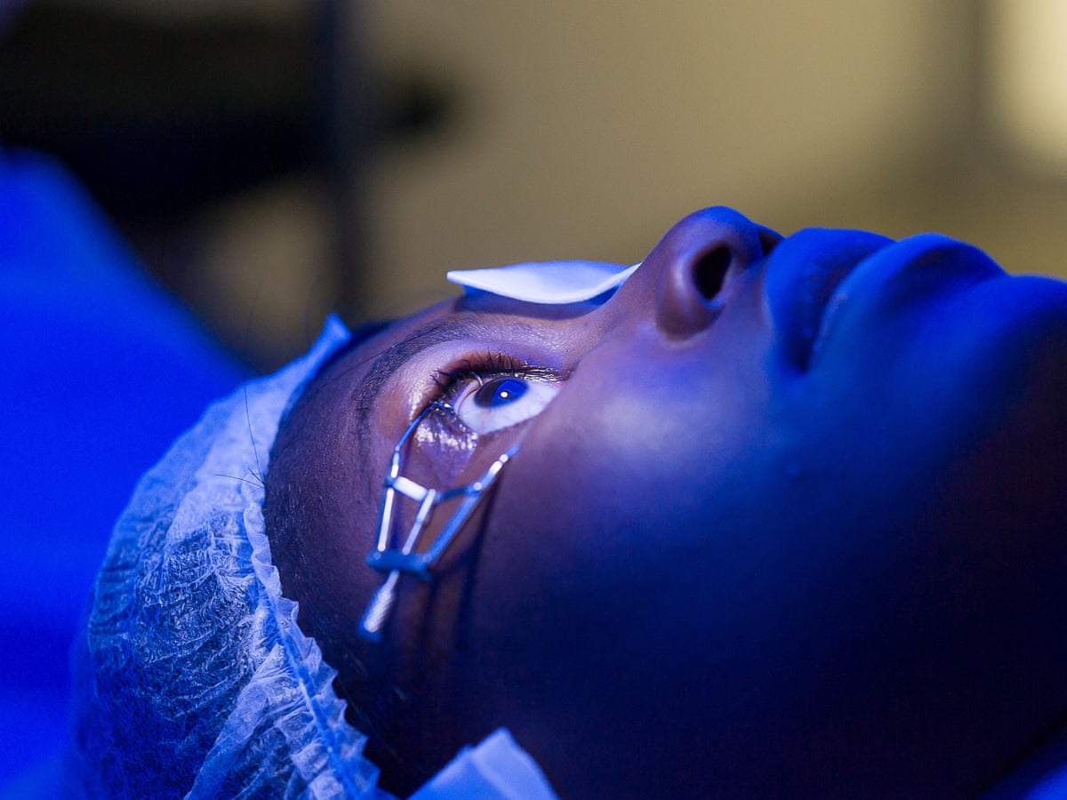 15 Minute Laser Is Best Treatment For Glaucoma Patients Says Study Health The Guardian