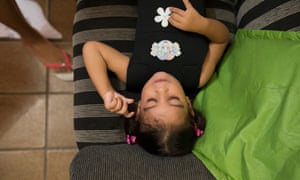 A child in Recife with microceph
