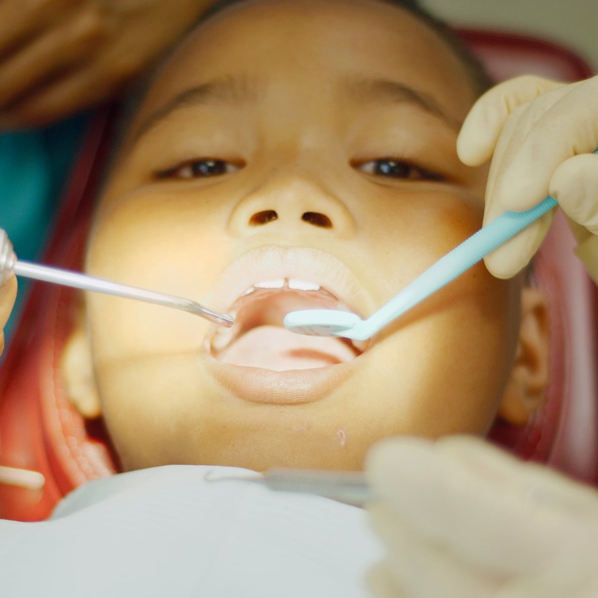 The Nhs Dental Service Is Broken And Its Rotten Payment System Is To Blame Dentists The Guardian