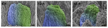 Electron microscope images of human tooth enamel that has been repaired for six, 12 and 48 hours. The blue area is the native enamel; the green is the repaired enamel.