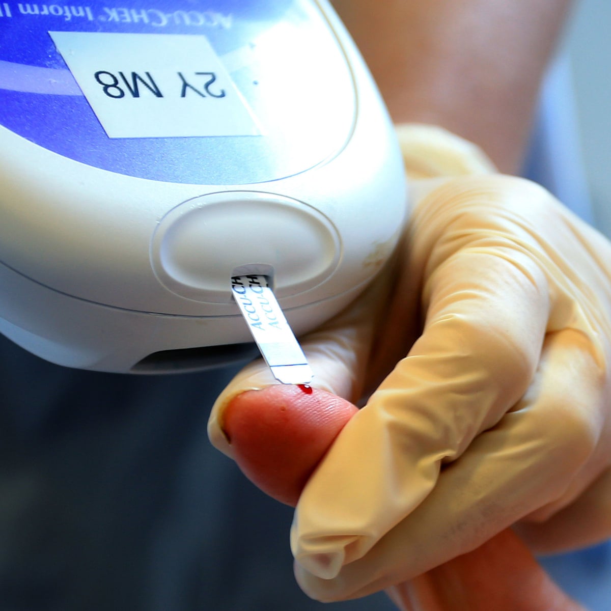 why does obesity cause diabetes you