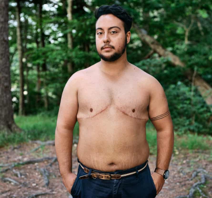 Jake Vargas, a student in Lincoln, Nebraska, standing, naked from the waist up, in front of trees