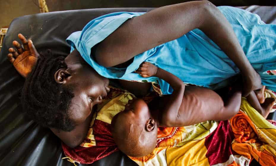 A mother breastfeeding a child with acute malnutrition at an MSF clinic in Aweil, in Northern Bahr el Ghazal state.
