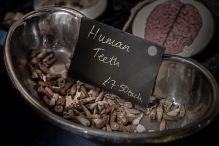 A steel surgical bowl filled with teeth and a sign advertising them as human teeth for £7.50 each
