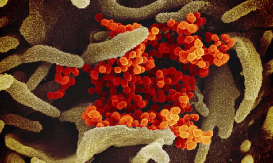 An electron microscope image showing the novel coronavirus, orange, emerging from the surface of cells, green, cultured in the lab.
