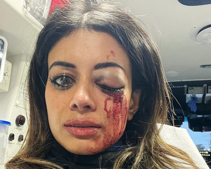 Police officer charged with assault after Hannah Thomas injured at pro-Palestine protest in Sydney