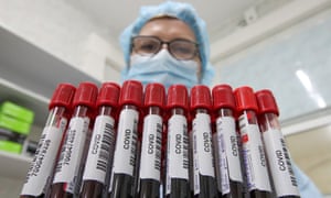 A healthcare worker holds vials with blood samples while performing laboratory tests for Covid-19
