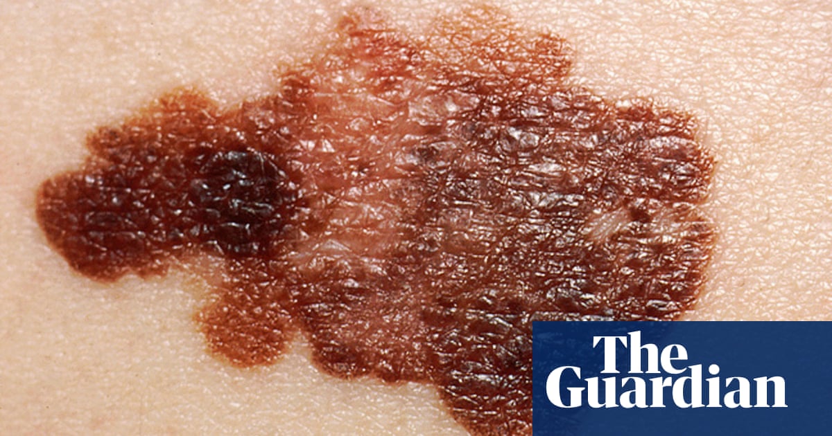 4300.jpg?width=1200&height=630&quality=8