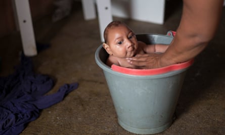 Solange Ferreira bathes her son Jose Wesley, who has microcephaly, in a bucket at their house in Poco Fundo, Pernambuco state, Brazil. Ferreira says her son enjoys being in the water and she places him in the bucket several times a day to calm him.