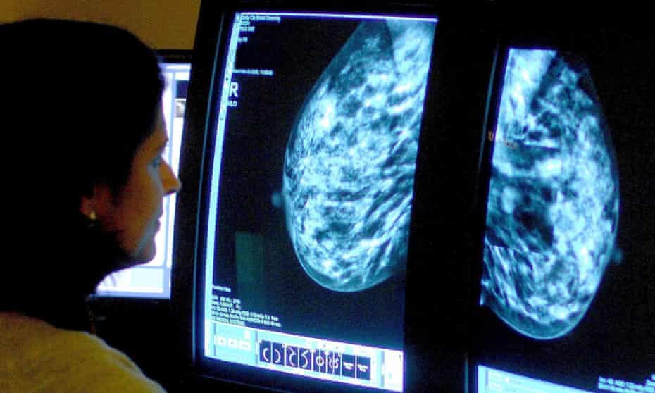 breast cancer mammogram