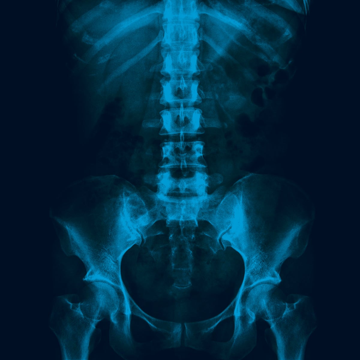 A Crunch A Rip Pain Spread Like A Stain My Lifetime Of Back Trouble Back Pain The Guardian A Crunch A Rip Pain Spread Like A Stain My Lifetime Of Back Trouble Back Pain The Guardian