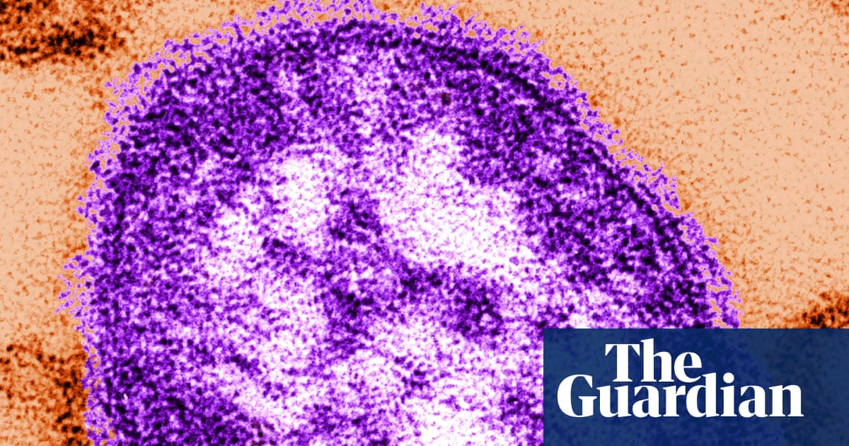 Six-week-old child in Pennsylvania dies from measles, coroner says
