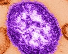 Six-week-old child in Pennsylvania dies from measles, coroner says