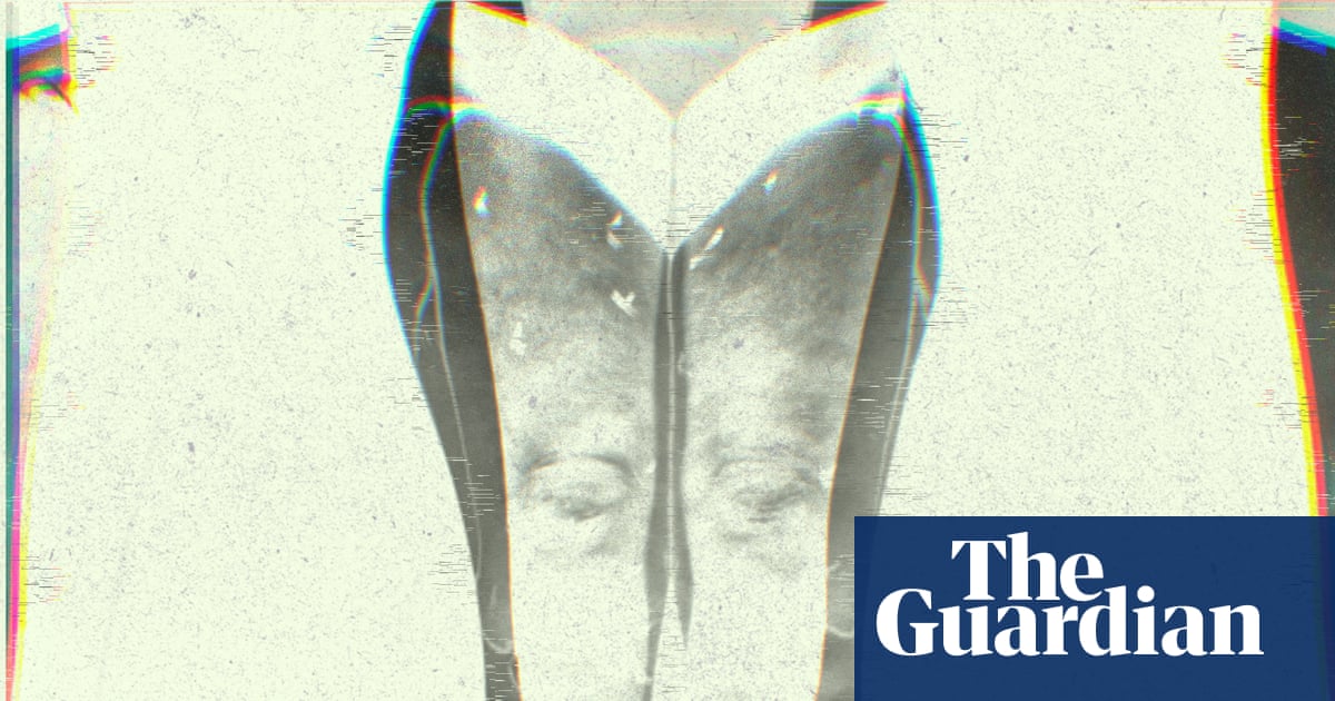 Puffy legs, heavy aches, rippled skin: what is lipedema? | Well actually | The Guardian Puffy legs, heavy aches, rippled skin: what is lipedema? | Well actually | The Guardian
