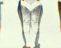 A graphic illustration that appears to show a woman's legs, overlaid on a separate image of larger legs.