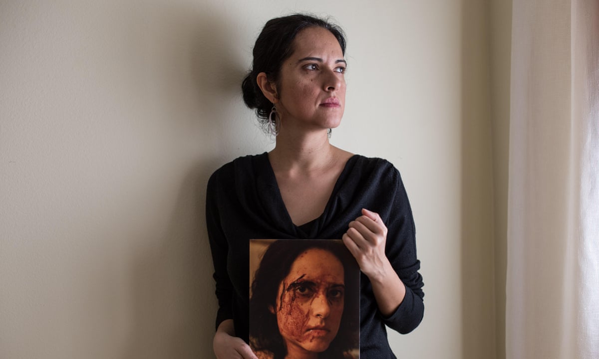 After I was assaulted, I posted a photo of my injuries. The reaction I craved was not pity, but anger | Egypt | The Guardian