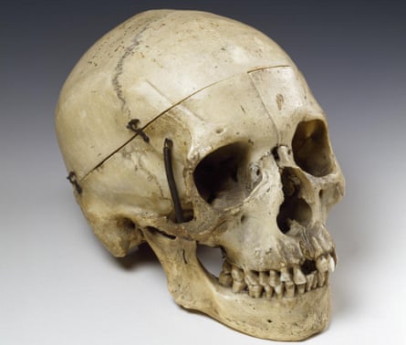 When Sarah Bernhardt played Hamlet, she used this real skull, a gift from Victor Hugo.