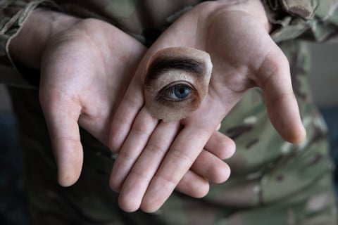 Blinded by War: фотопроєкт про поранених українських військових після війни
