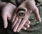Blinded by War: documenting the aftermath of injury in Ukraine – photo essay