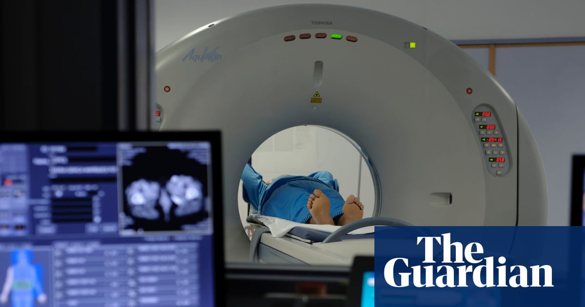 Η αύξηση βάρους ως ενήλικας αυξάνει τον κίνδυνο καρκίνου έως και πέντε φορές, σύμφωνα με έρευνα