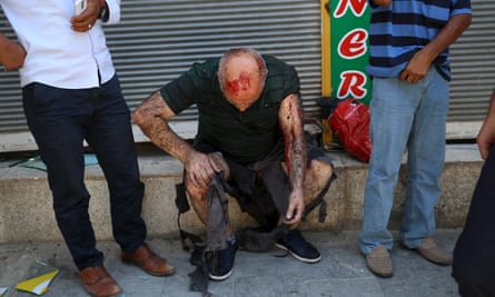 A wounded man sits down after the explosion