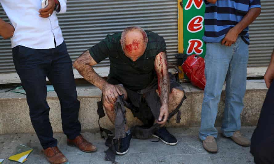 A wounded man sits down after the explosion
