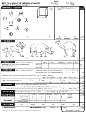 One of the MoCA cognitive tests