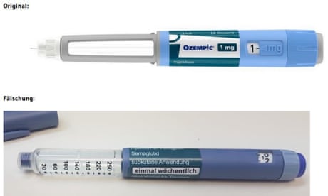 semaglutide game changer Weight Loss Weapon or Wellness Wonder? The Inside Story on Semaglutide semaglutide game changer Weight Loss Weapon or Wellness Wonder? The Inside Story on Semaglutide
